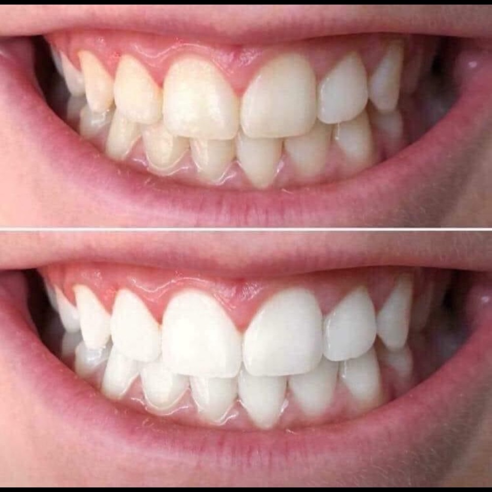 Whitening toothpaste! - Picture 3 of 11